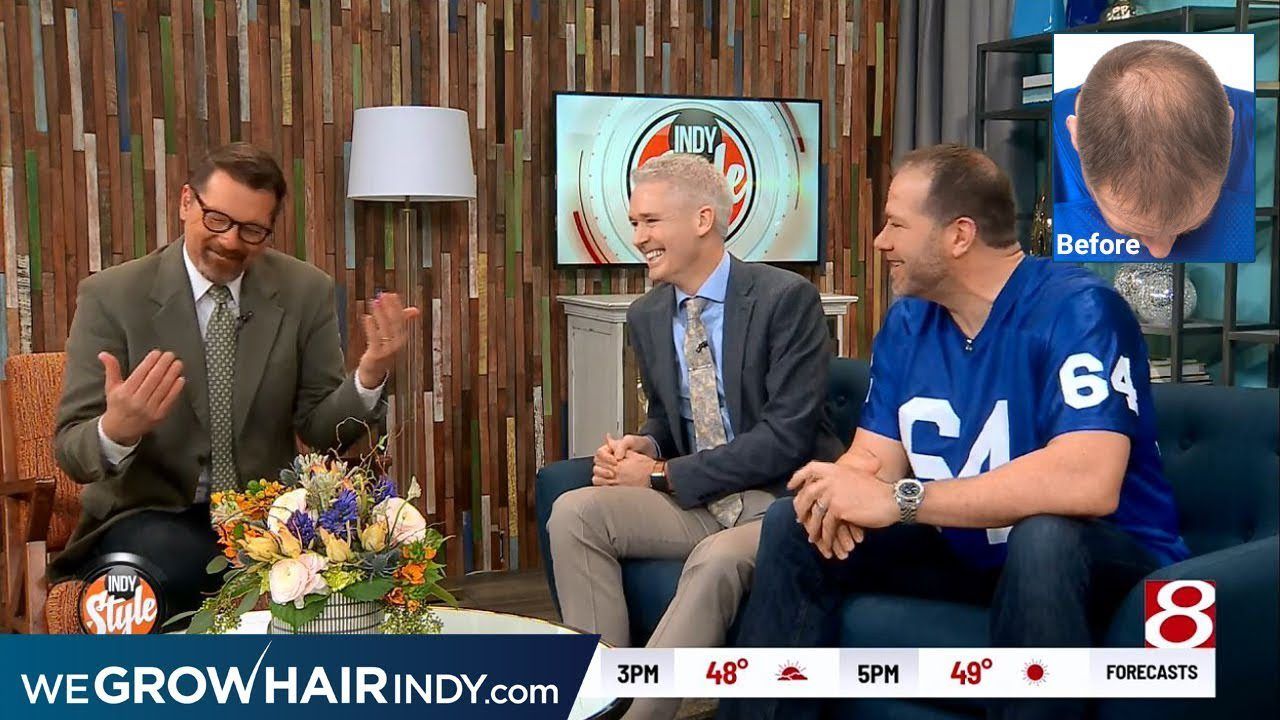 Tackling Hair Loss! - Rick DeMulling on WISHTV Indy Style