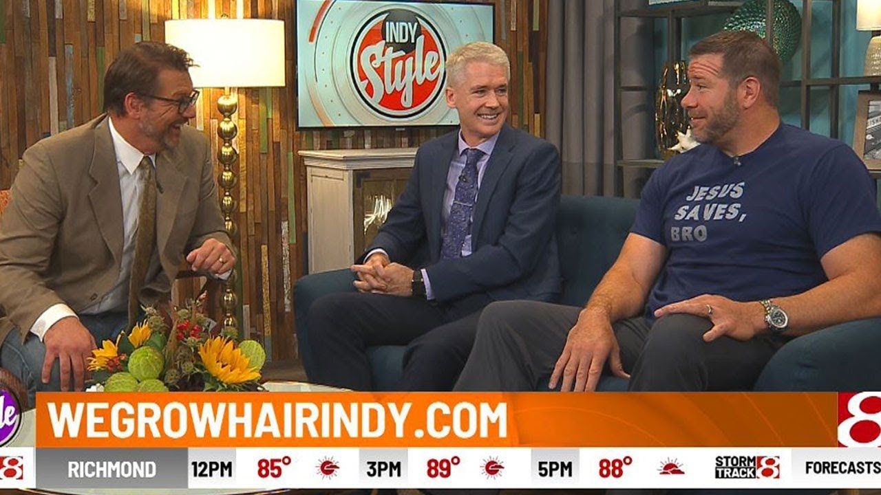 Hair Transplant 6 Month Update  Rick DeMulling on WISH-TV Indy Style