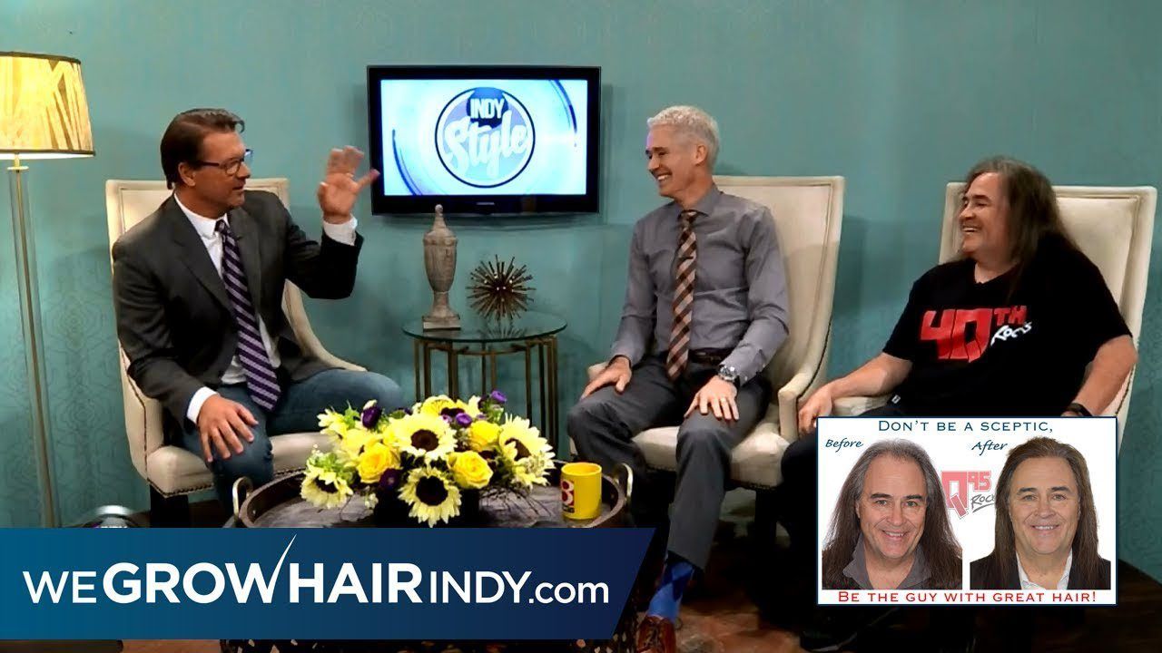 Don Stuck on INDY Style | Final Hair Transplant Results