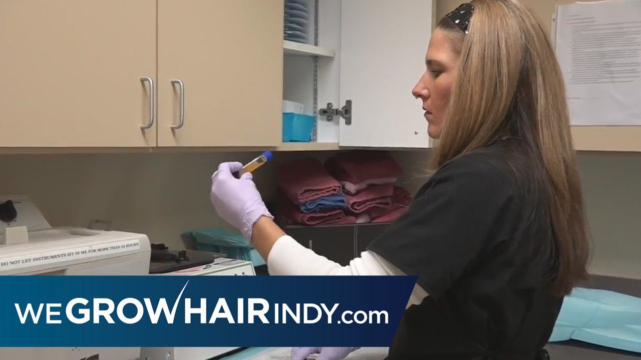 Enhanced Plasma Therapy to Treat Thinning Hair