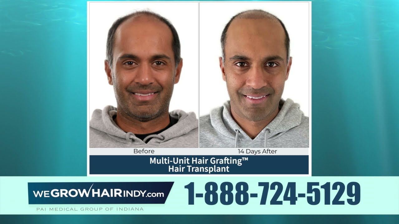 Rajeev Ram and We Grow Hair Indy on Fox 59 Marketplace