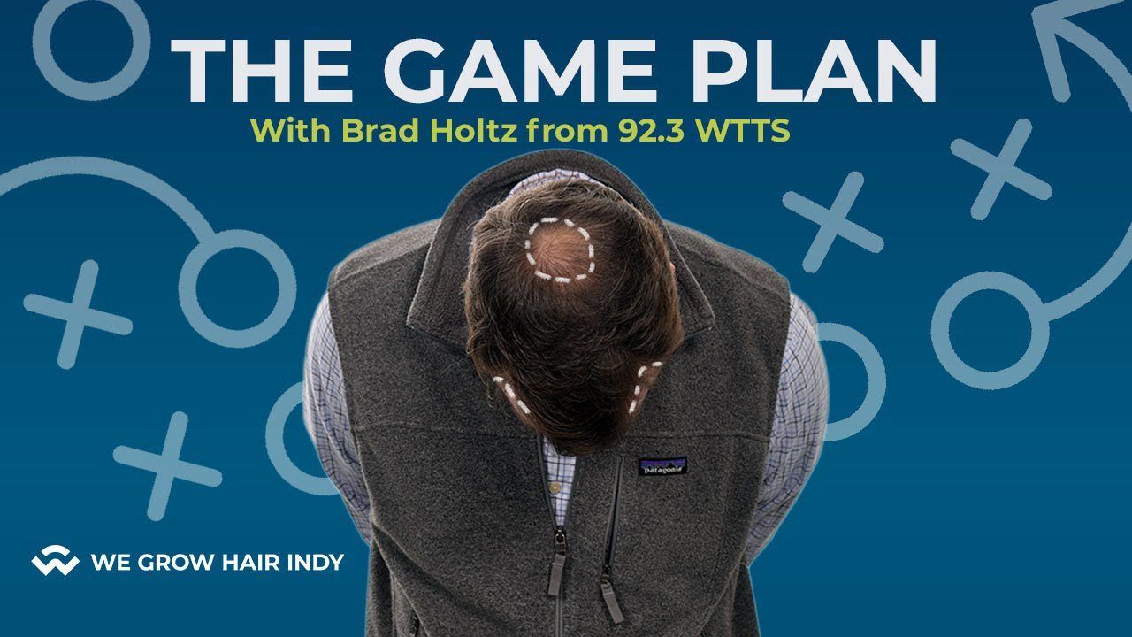 The Hair Transplant Game Plan - Crown & Hairline Restoration I WGHI VIP I Brad Holtz