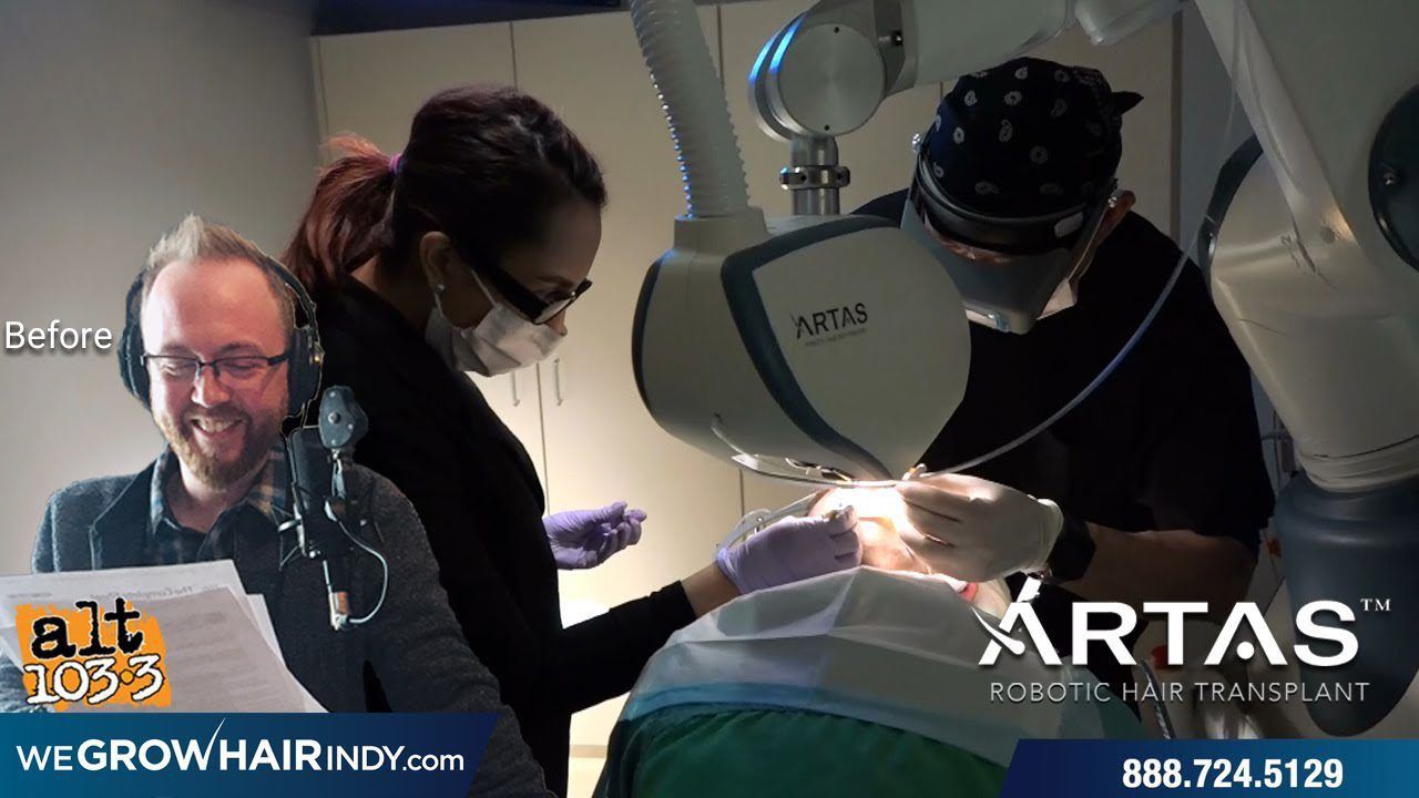 ARTAS Robotic FUE Day of Procedure - Alt 103.3FM