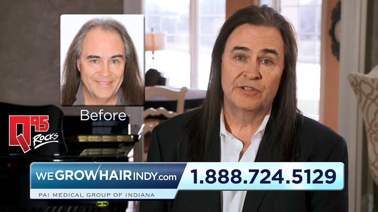 Hair Good Enough for TV! Don Stuck Hair Transplant