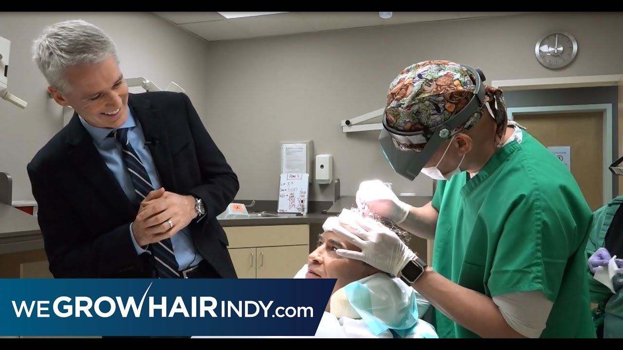 Watch a Hair Transplant Procedure - Don Stuck