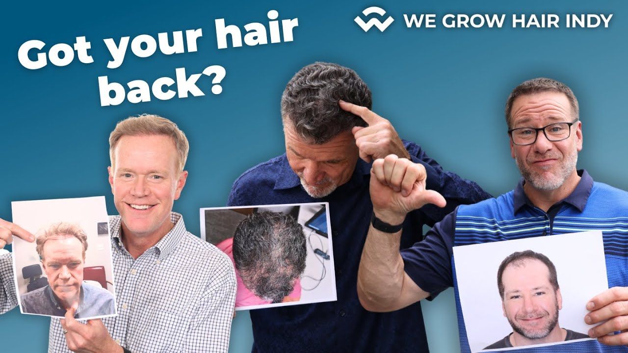 Get Your Hair Back at We Grow Hair Indy - 25 Years of Hair Restoration