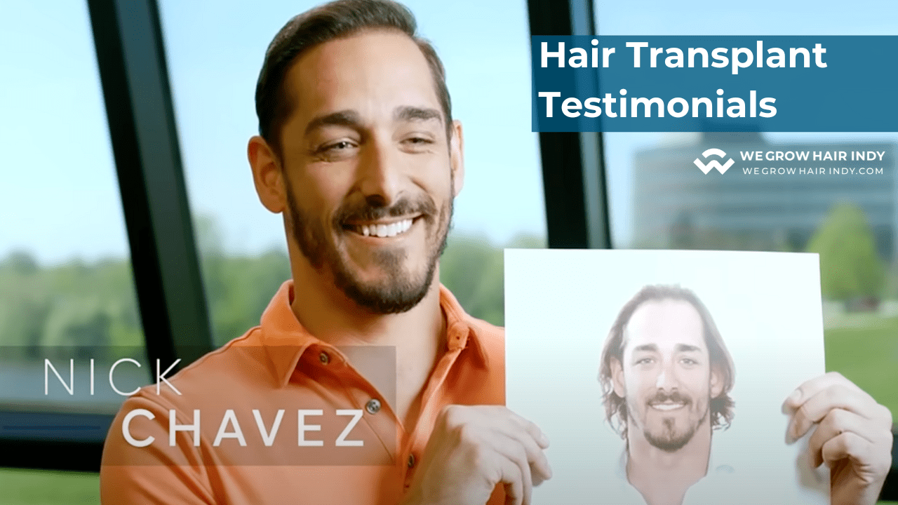 Multi-Unit Hair Grafting™ Hair Transplant Testimonials - We Grow Hair Indy