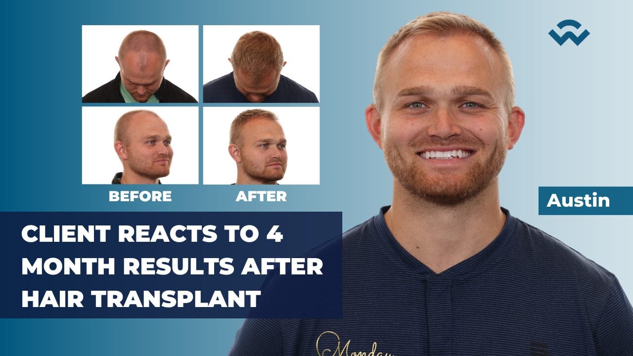 austin monday 4 month results