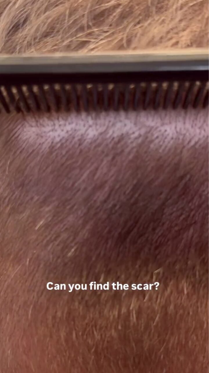 Trichophytic closure