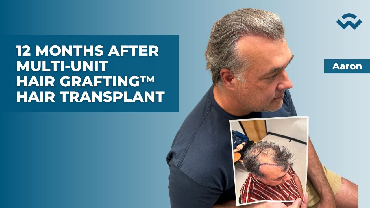 aaron fleehearty Multi-Unit Hair Grafting&trade;