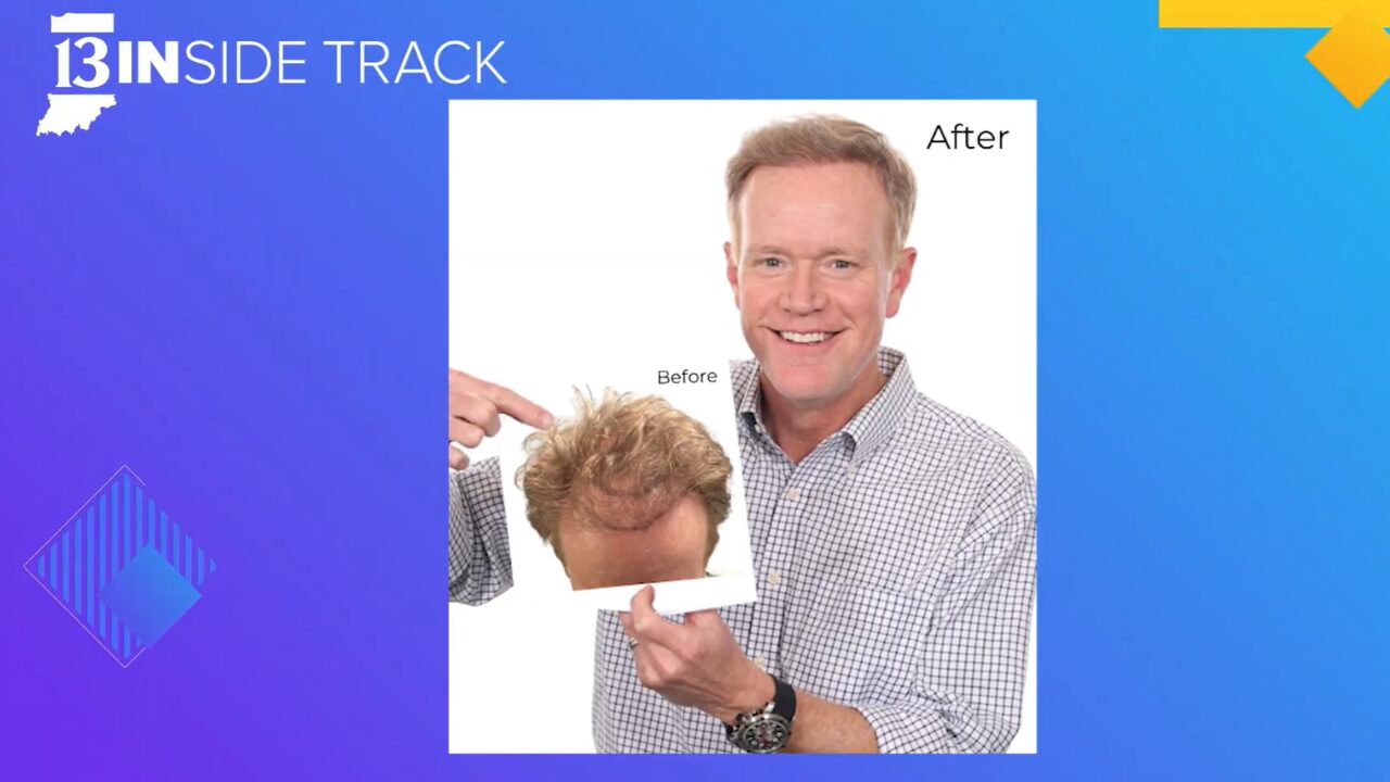 we grow hair indy may 2026 inside track