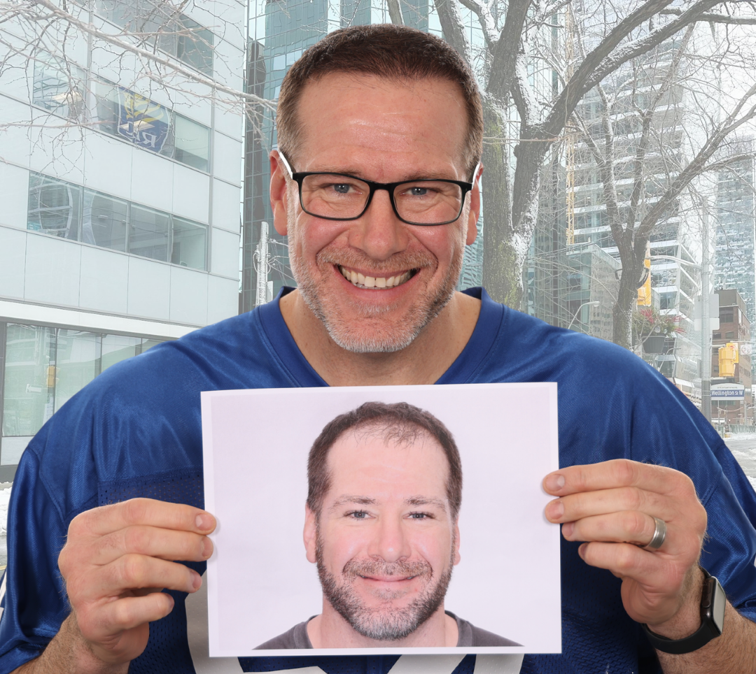 rick demulling we grow hair indy